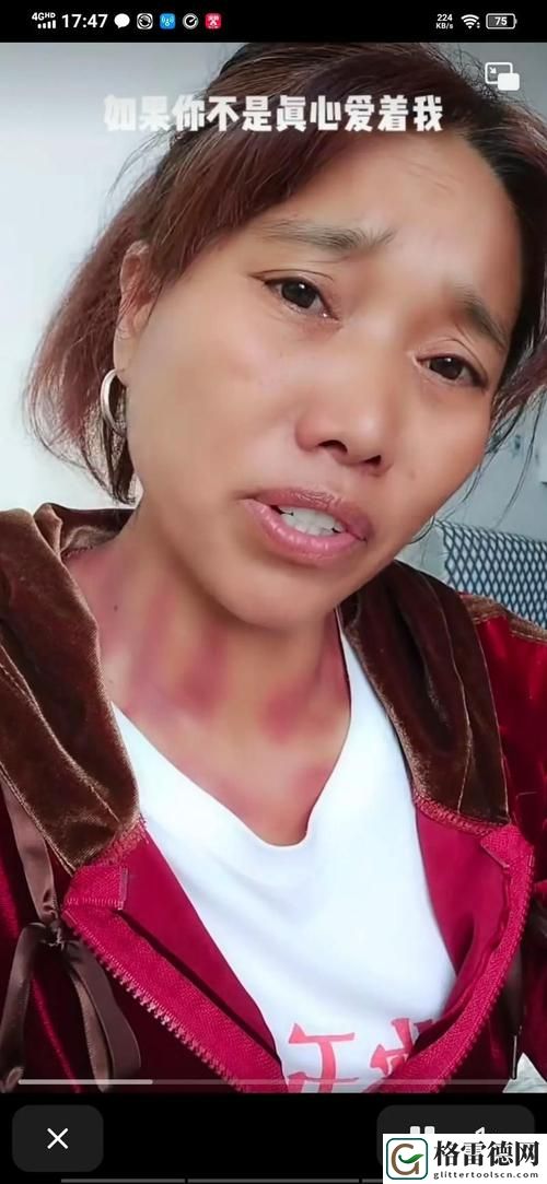  如何应对“H多p太深拔出来疼痛怎么办”的难题