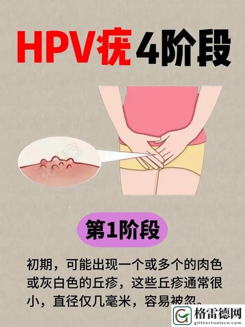  女人热潮时一夹一夹会得HPV吗？探讨女性健康与感染风险