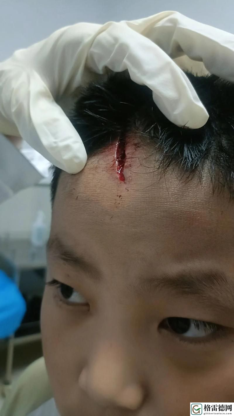 老公咬我小头头弄破皮了